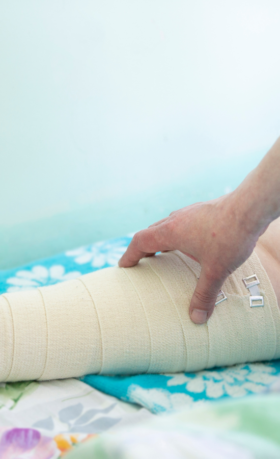 A patient suffering from Lymphedema wears medical wrap on leg extended on bed